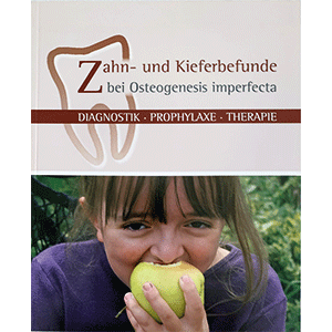 Zahn- und Kieferbefunde bei Osteogenesis imperfecta